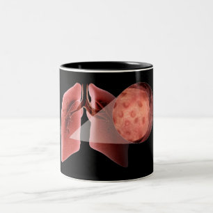 Inflammed airway during an asthma attack Two-Tone coffee mug