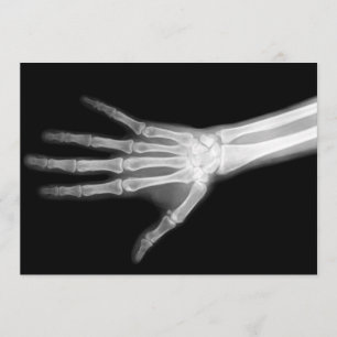 Invitation Armoiries de Skeleton, en noir et blanc
