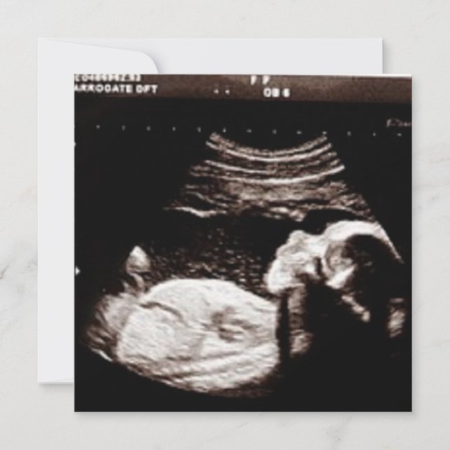Invitation Baby shower d'images Ultrasound personnalisées (Devant)