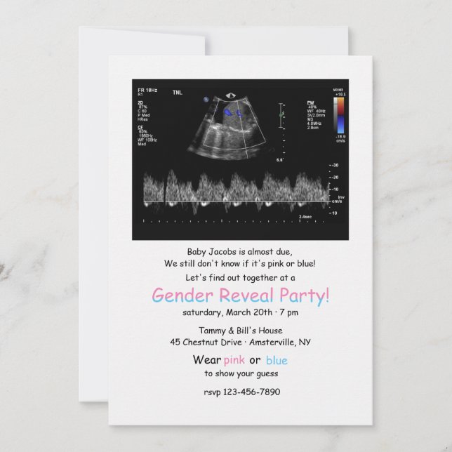 Invitation Doppler foetal Image Gender Revevela Party Invitat (Devant)