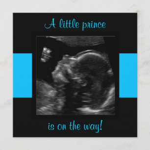 Invitation Garçon Baby Customisé Modèle photo Ultrasound