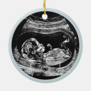 Its a Boy Ultrasound Pregnancy Announcement Baby Ceramic Ornament