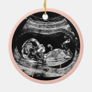 Its a Girl Ultrasound Pregnancy Announcement Baby Ceramic Ornament
