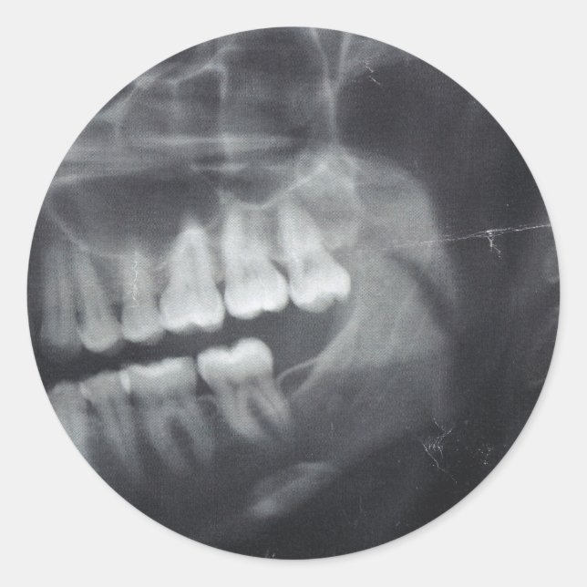 Jaw Stickers (Front)