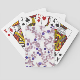 Jeu De Cartes Cellules Lymphocytaires Néoplastiques
