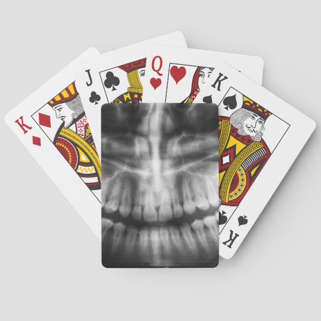 Jeu De Cartes X-Ray Teeth Bouche sourire noir et blanc (dos)