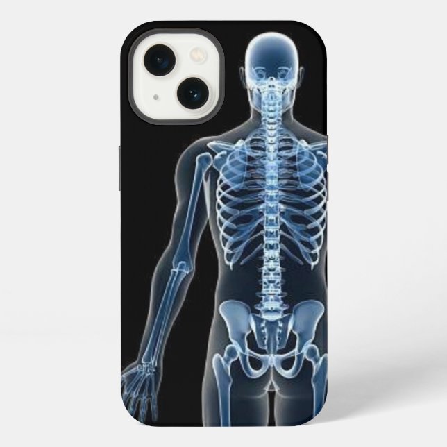 John Doe X-ray iPhone Case (Back)