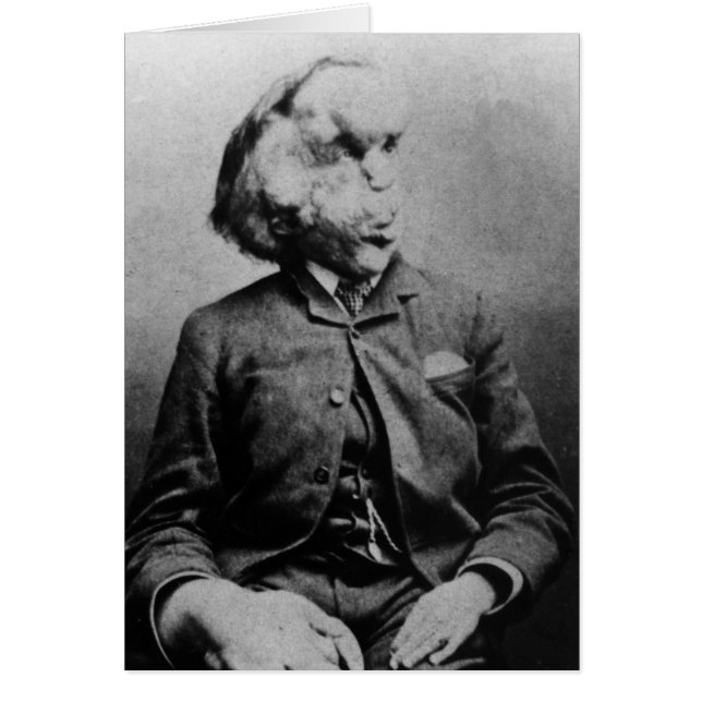 Joseph "John" Merrick L'homme éléphant de 1889 (Devant)