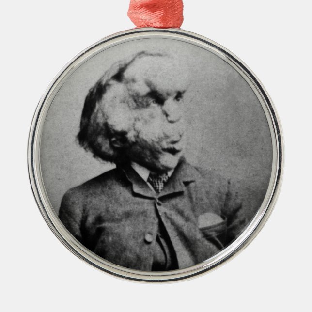 Joseph "John" Merrick The Elephant Man from 1889 Metal Ornament (Front)