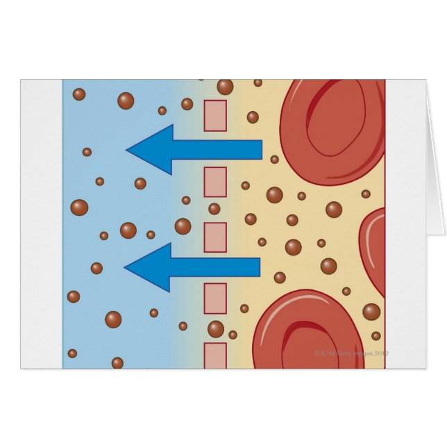 Kidney Dialysis (Front Horizontal)