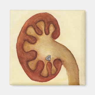 kidney stone magnet