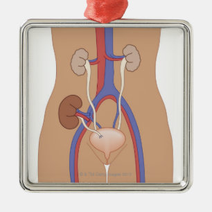 Kidney Transplant Metal Ornament