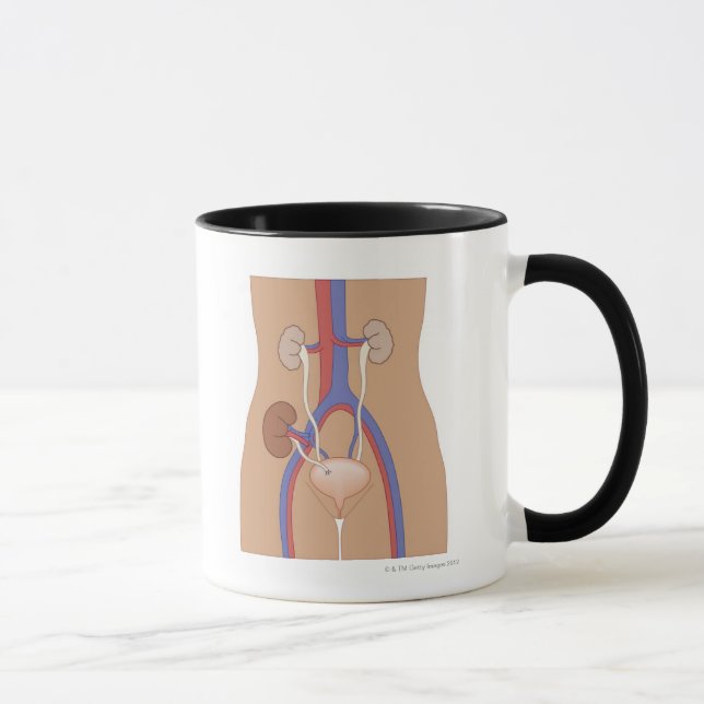 Kidney Transplant Mug (Right)