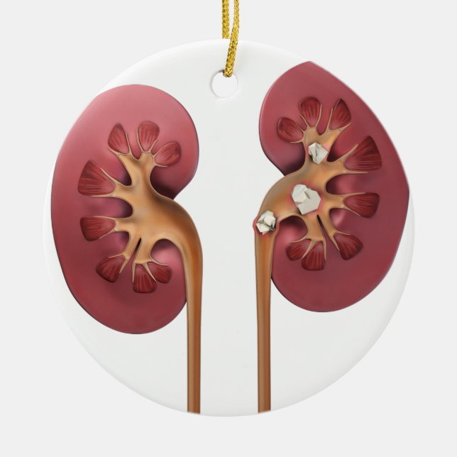 kidneys ceramic ornament (Front)