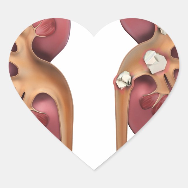 kidneys heart sticker (Front)