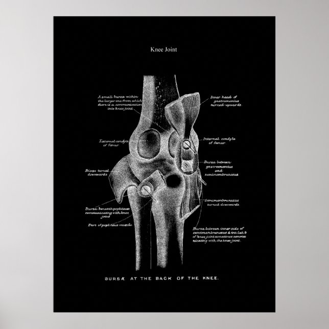 Knee Joints Anatomy Art Poster (Front)