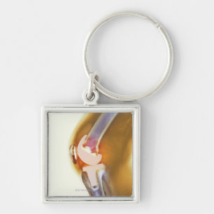 Knee replacement. Coloured X-ray of a total knee Keychain