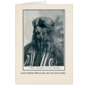Lionel, the Lion Faced Boy Cards and Postcards