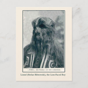 Lionel, the Lion Faced Boy Cards and Postcards