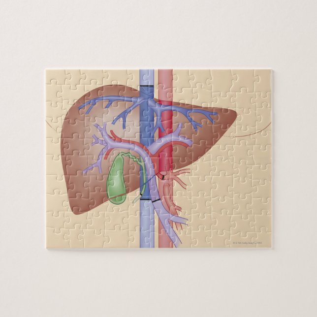 Liver Transplant Procedure Jigsaw Puzzle (Horizontal)