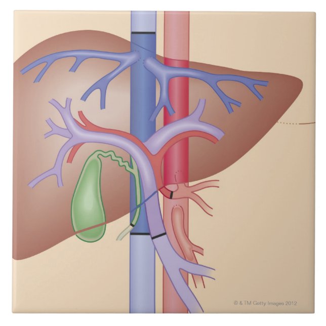 Liver Transplant Procedure Tile (Front)