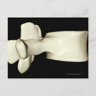 Lumbar Vertebra Postcard