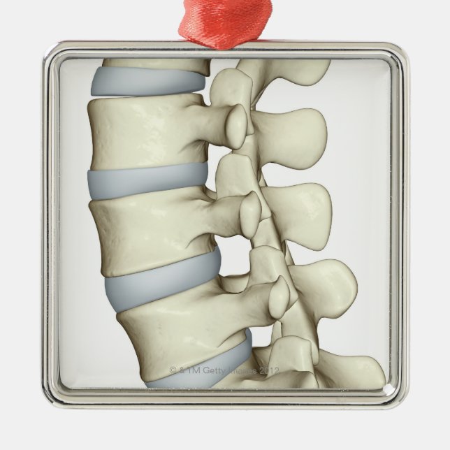 Lumbar Vertebrae Metal Ornament (Front)