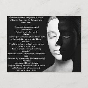 Lupus the silent partner... postcard