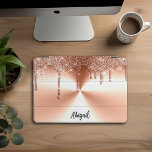 Luxury Sparkle Rose Gold Dripping Glitter Personal iPad Pro Cover<br><div class="desc">Beautiful Luxury Sparkle Rose Gold Dripping Glitter With Brushed Metal Texture Design Personalized iPad Pro</div>