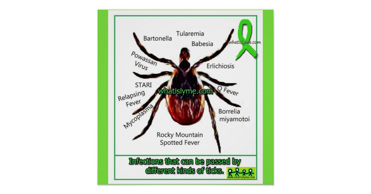Lyme Disease & Co Infection Educational Chart | Zazzle.ca