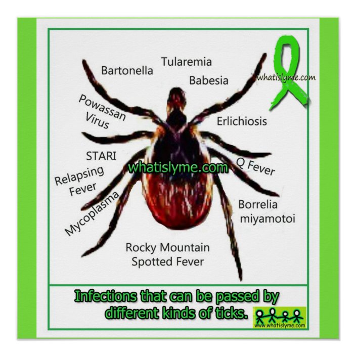 Lyme Disease & Co Infection Educational Chart Zazzle.ca