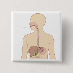 Macaron Carré 5 Cm Itinéraire d'endoscope