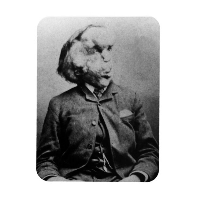 Magnet Flexible Joseph "John" Merrick L'homme éléphant de 1889 (Vertical)