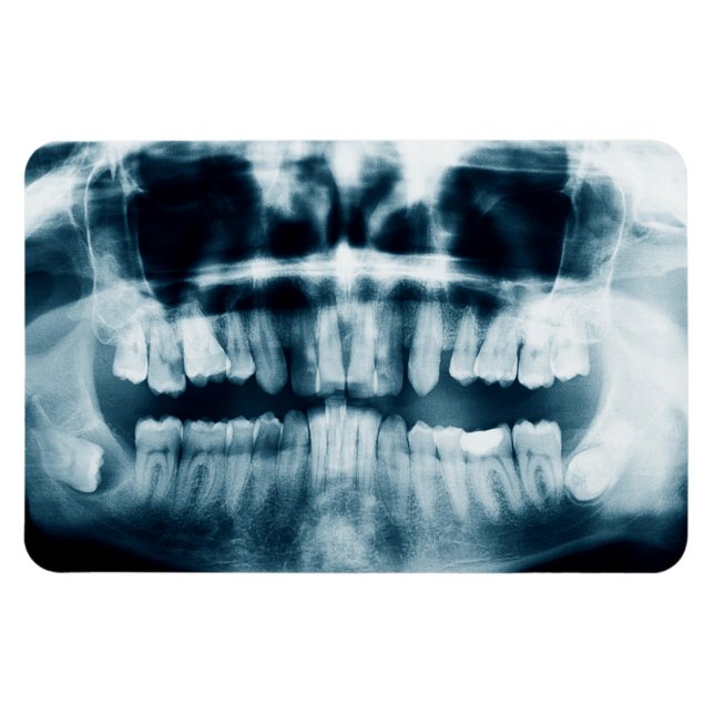 Magnet Flexible Rayon X des dents (Horizontal)