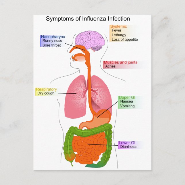 Main Symptoms of an Influenza Infection Diagram Postcard (Front)