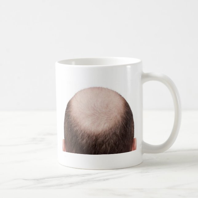 Male Pattern Baldness Coffee Mug (Right)