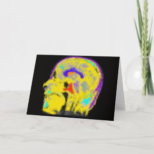 Mark's colorized MRI Card