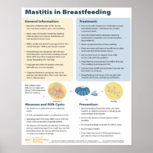 Mastitis in Breastfeeding Poster (English)