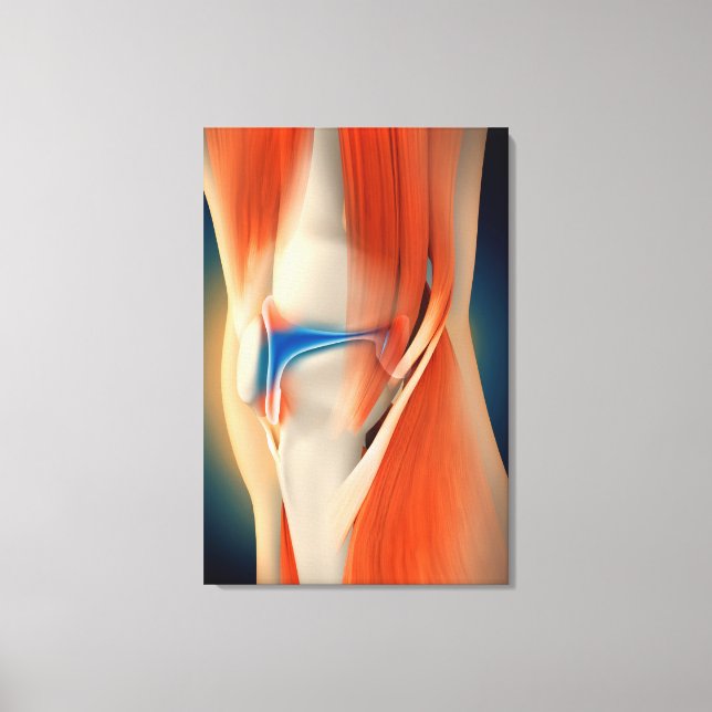 Medical Illustration: Inflammation In Knee Canvas Print (Front)