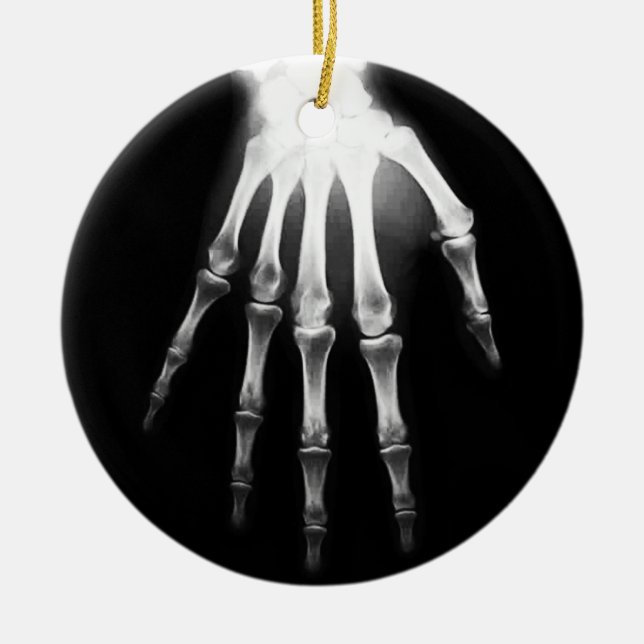 Medical X-Ray Doctor Hospital X-Ray Hand Ceramic Ornament (Front)
