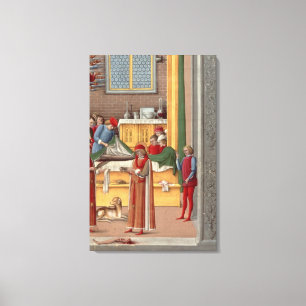 Medieval amputation scene canvas print