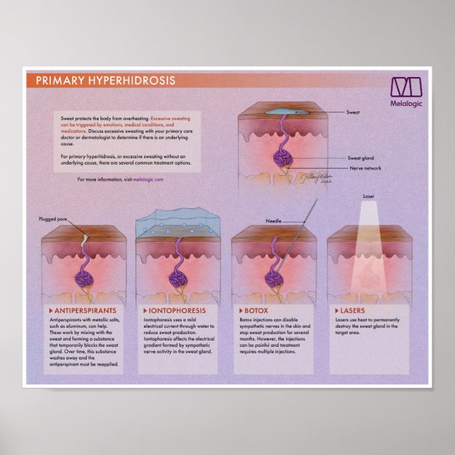 Melalogic Hyperhidrosis Medical Poster (Front)