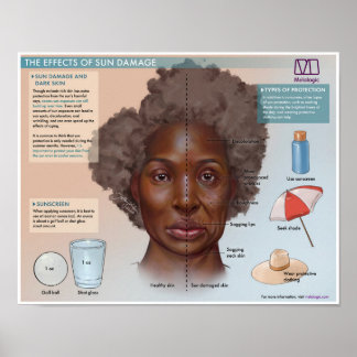 Melalogic The Effects of Sun Damage Medical Poster