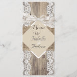 Menu Rustic Wedding Beige White Lace Wood Burlap 2<br><div class="desc">Dinner Menu Rustic Wedding,  Beige White lace Wood and burlap hessian,  Country Marriage,  Hessian Invitation hessian wedding invitation, </div>