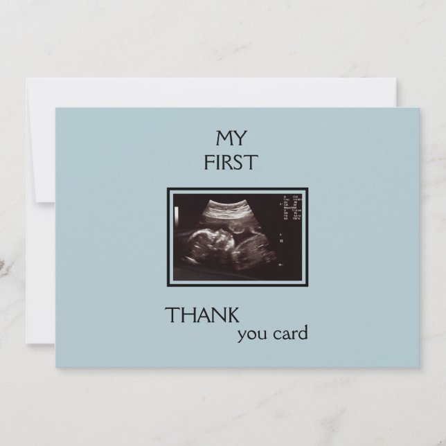 Merci photo Ultrasound de Baby Point de vue (Devant)