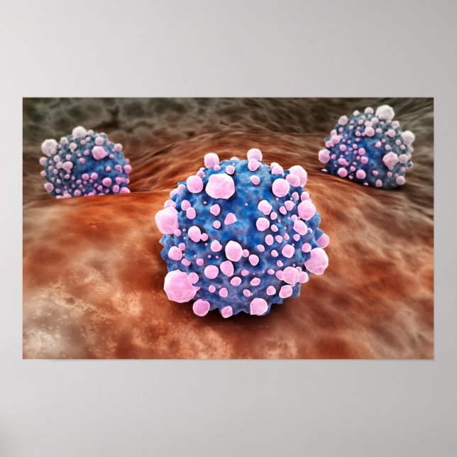 Microscipic View Of Pancreatic Cancer Cells 2 Poster (Front)
