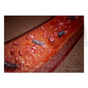 Microscopic rendering of a blood infection