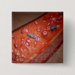 Microscopic rendering of a blood infection 2 inch square button
