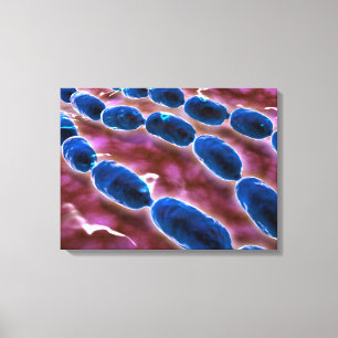 Microscopic View Of Bacterial Pneumonia 1 Canvas Print