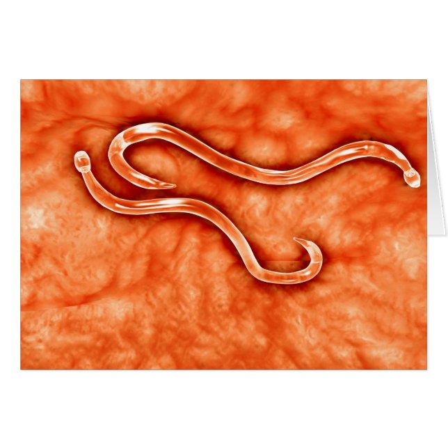 Microscopic View Of Hookworm 2 (Front Horizontal)